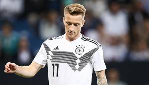 Marco Reus musste beim ersten Training der deutschen Nationalmannschaft in Leipzig verletzungsbedingt pausieren.