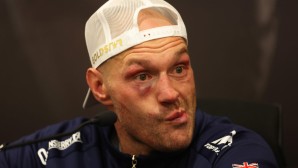 tyson-fury